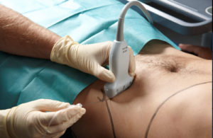 Ecografia-Pared-Abdominal-Inguinal-300x195