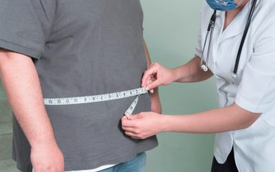 Balón intragástrico para la obesidad: ¿cómo puede ayudarte?