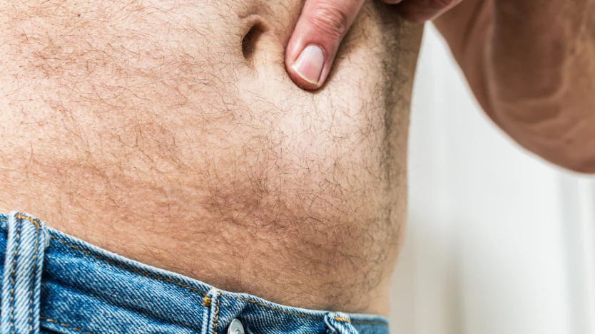 hernia estomago