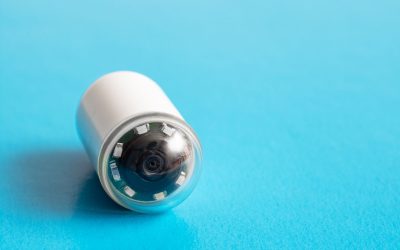 Cápsula endoscópica: un avance en la medicina digestiva
