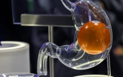 Balón intragástrico en el tratamiento de la obesidad