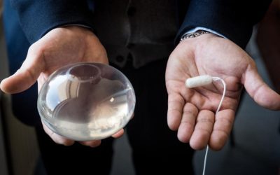 Balón intragástrico: alternativa eficaz para combatir la obesidad